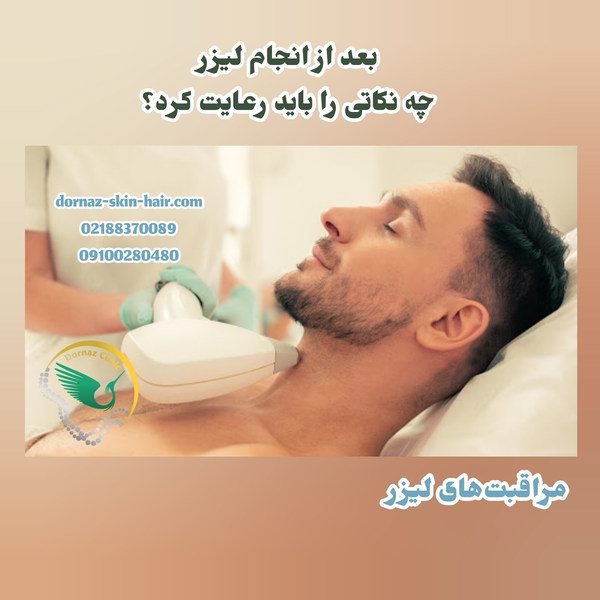 مراقبتهای لیزر بعد ار انجام آن