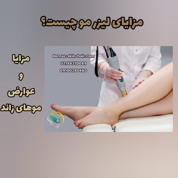 مزایا و عوارض لیزر موهای زائد