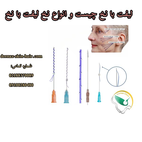 لیفت با نخ چیست و انواع نخ آن