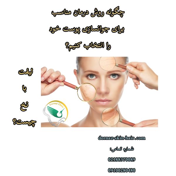 انتخاب بهترین روش لیفت صورت یعنی لیفت با نخ
