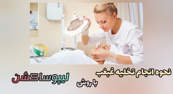 نحوه تخلیه غبغب در غرب تهران با لیپوساکشن