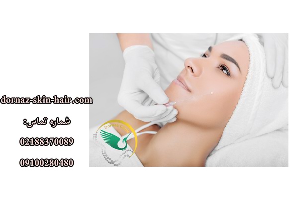 لیفت با نخ چیست و نواحی قابل درمان