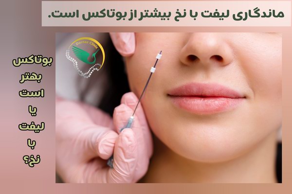 ماندگاری بوتاکس بهتر است یا لیفت با نخ