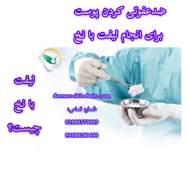 لیفت با نخ چیست و مرحله ضدعفونی آن چگونه انجام می‌گیرد