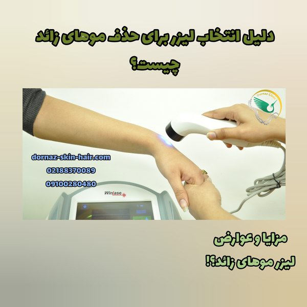 دلیل انتخاب لیزر و مزایا و عوارض لیزر موهای زائد