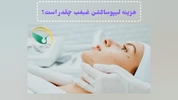 هزینه لیپوساکش برای تخلیه غبغب در غرب تهران