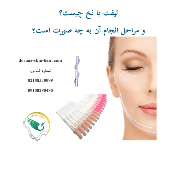 لیفت با نخ چیست و مراحل انجام آن