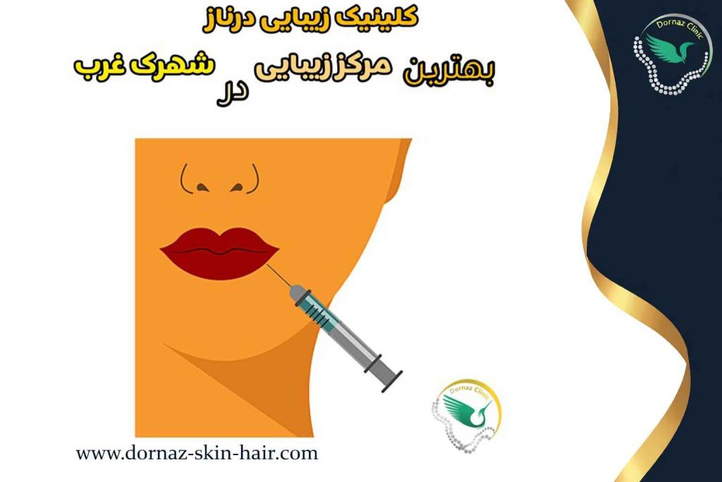 کلینیک درناز؛ بهترین کلینیک تزریق ژل و فیلر در شهرک غرب