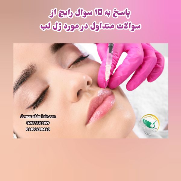 15 سوالات متداول در مورد ژل لب