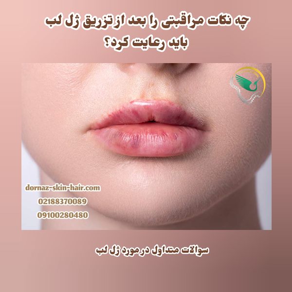 پاسخ به سوالات متداول در مورد ژل لب و نکات مراقبتی آن