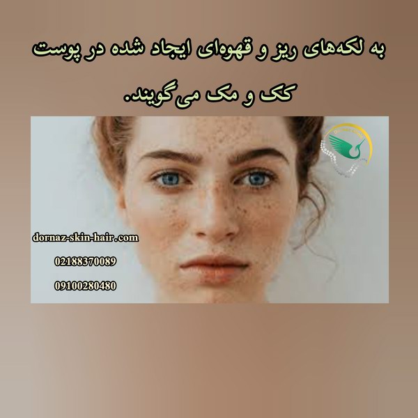 کک و مک 