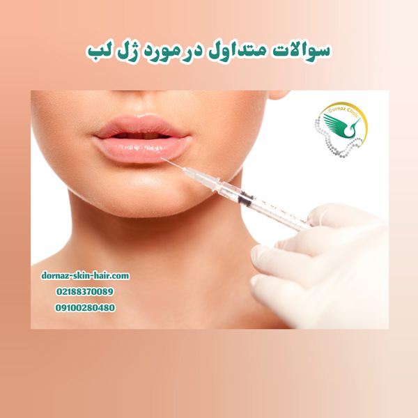 سوالات متداول در مورد ژل لب