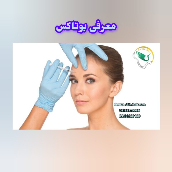 معرفی بوتاکس