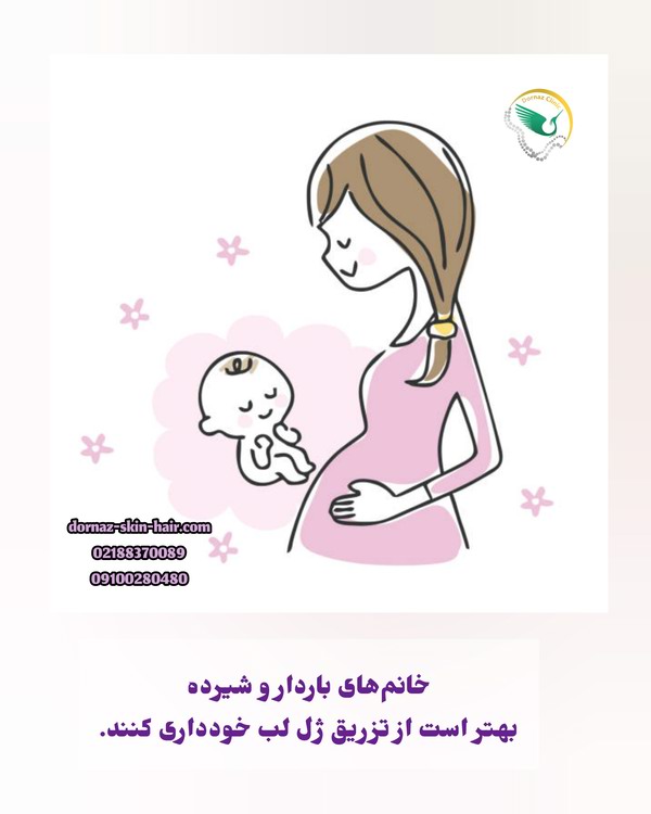 چه کسانی نباید ژل لب را تزریق کنند