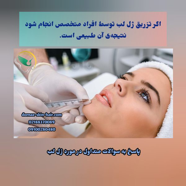 پاسخ به سوالات متداول در مورد ژل لب و نتیجه‌ی آن