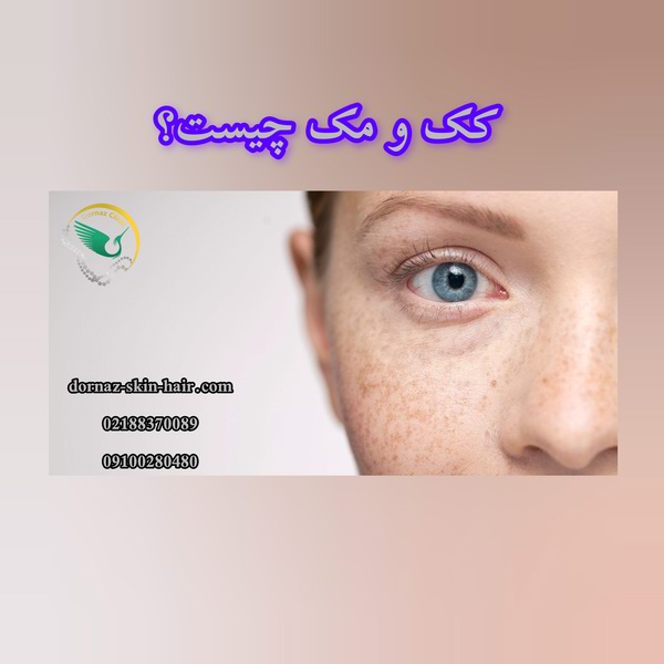 کک و مک چیست