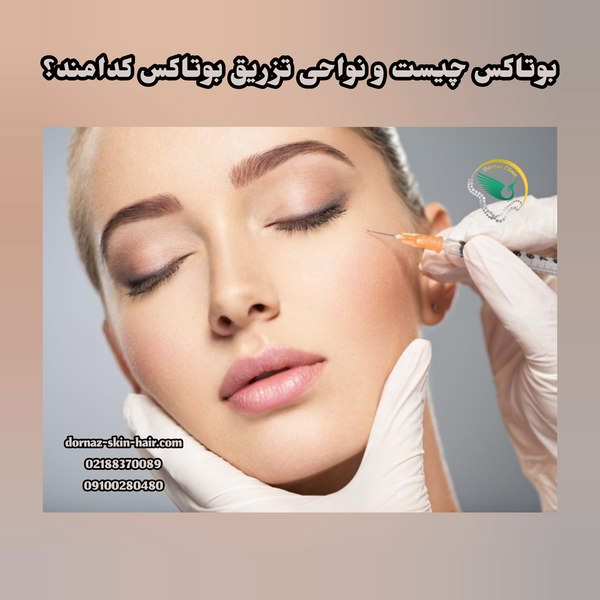 بوتاکس چیست و نواحی تزریق آن کدامند