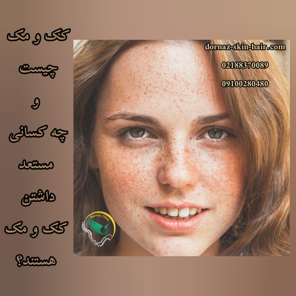 کک و مک چیست و چه کسانی مستعد داشتن آن هستند؟