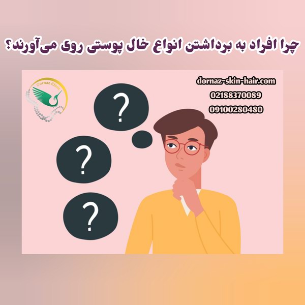 چرا افراد به برداشتن خال پوستی روی میآورند؟