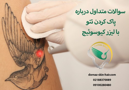 سوالات متداول