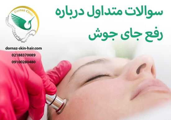 سوالات متداول