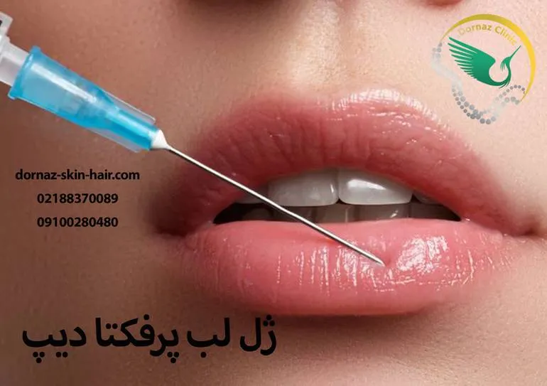 ژل لب پرفکتا دیپ