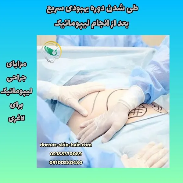 دوره بهبودی سریع جراحی لیپوماتیک