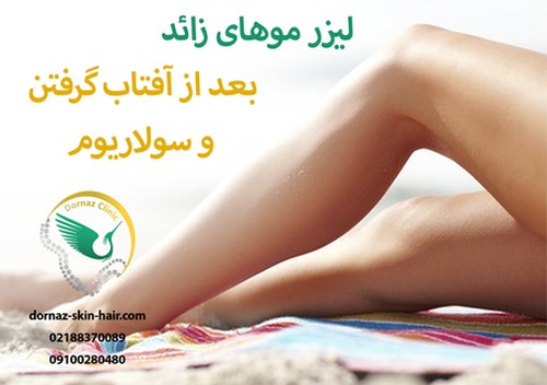 لیزر موهای زائد