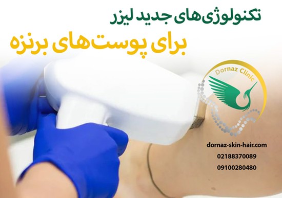 تکنولوژی های جدید