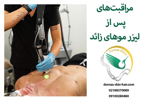 مراقبت های قبل و بعد از لیزر