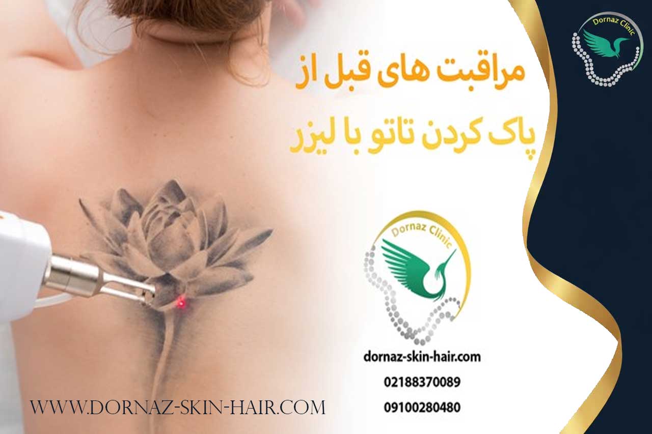 مراقبت قبل پاک کردن تتو