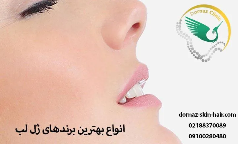 انواع بهترین برندهای ژل لب