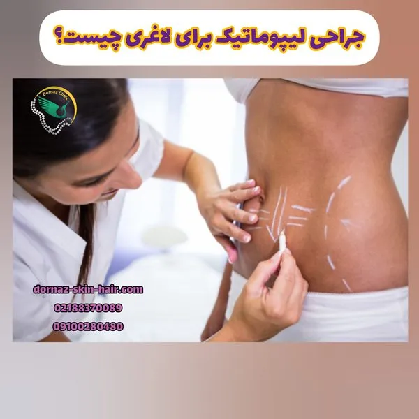 جراحی لیپوماتیک برای لاغری چیست؟