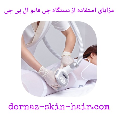 مزایای استفاده از دستگاه جی فایو ال پی جی