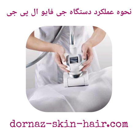 نحوه عملکرد دستگاه جی فایو ال پی جی
