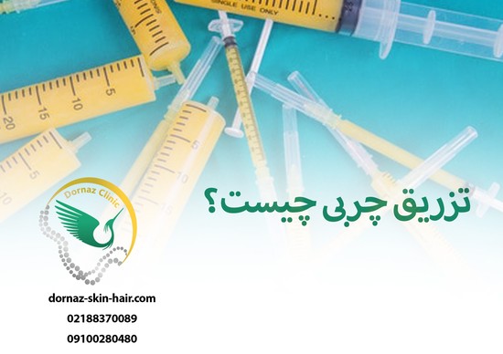 تزریق چربی چیست
