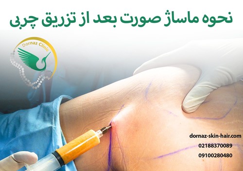 ماساژ بعد از تزریق چربی در غرب تهران