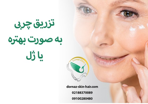 تزریق ژل یا چربی