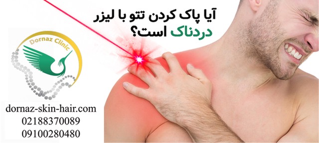 آیا پاک کردن تتو با لیزر دردناک است؟