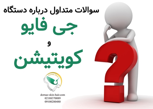 سوالات متداول درباره دستگاه جی فایو و کویتیشن