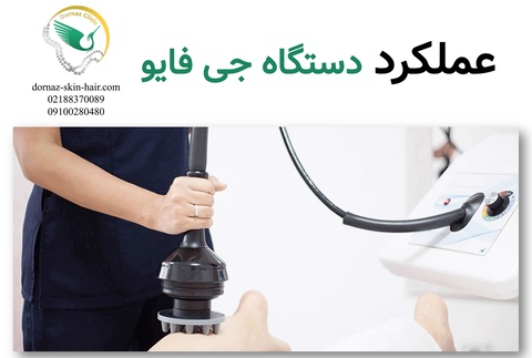 عملکرد دستگاه جی فایو