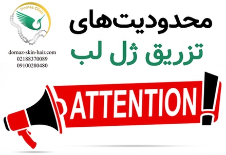 محدودیت های تزریق ژل لب