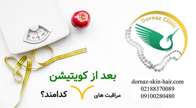 مراقبت های بعد از کویتیشن کدامند؟