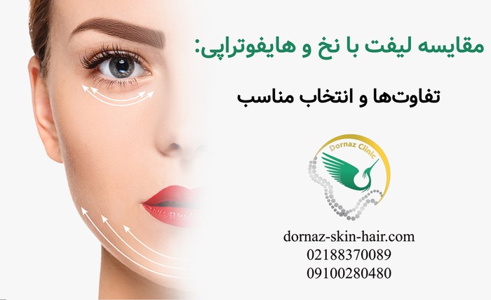 مقایسه لیفت با نخ و هایفوتراپی: تفاوت ها و انتخاب مناسب