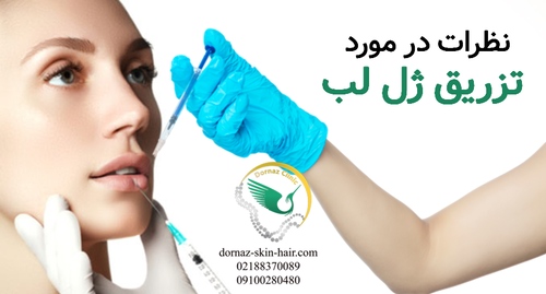 نظرات در مورد تزریق ژل لب