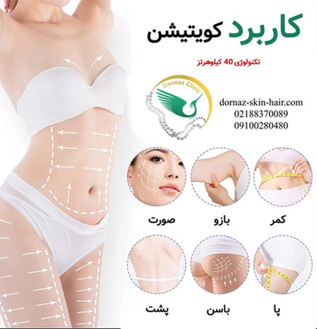 کاربرد کویتیشن