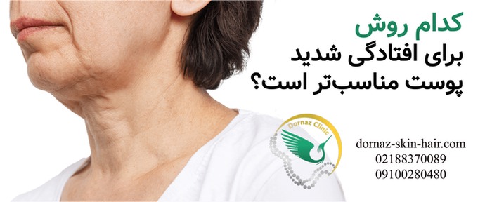 کدام روش برای افتادگی پوست مناسب تر است؟