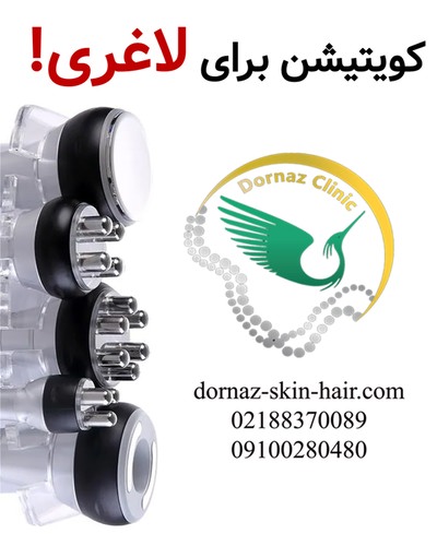 کویتیشن برای لاغری