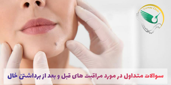 مرکز برداشتن خال در پونک