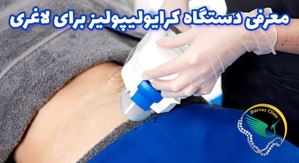 لاغری با کرایولیپولیز
